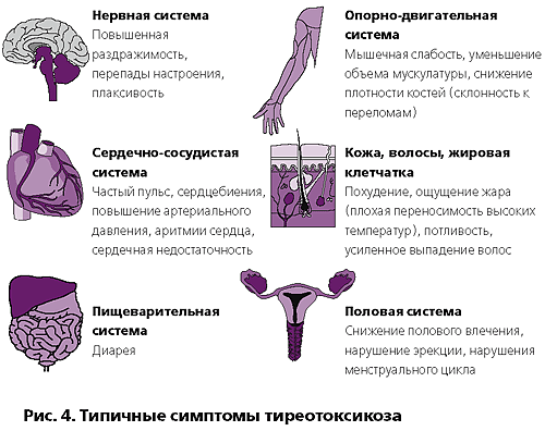 Типичные симптомы тиреотоксикоза