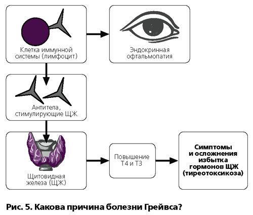 Болезнь Грейвса